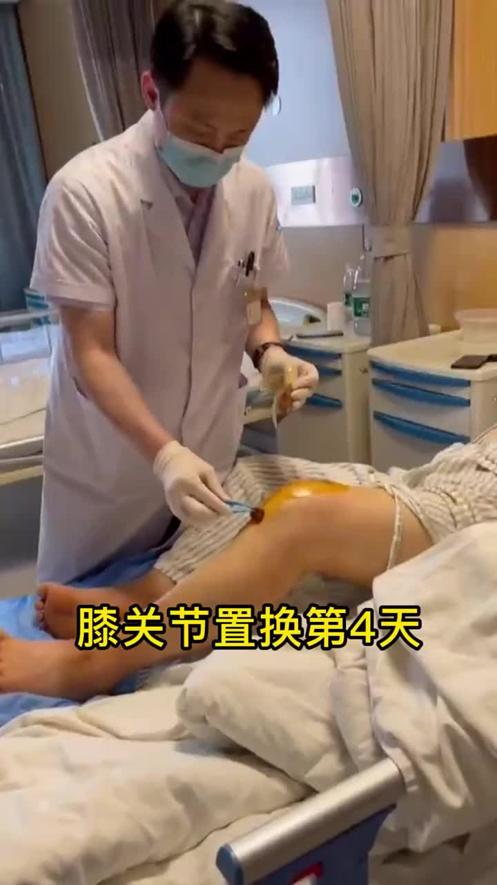 膝关节置换第4天,伤口愈合很好