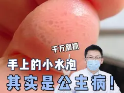 Descargar video: 手上长这种东西的女生…千万要注意！！