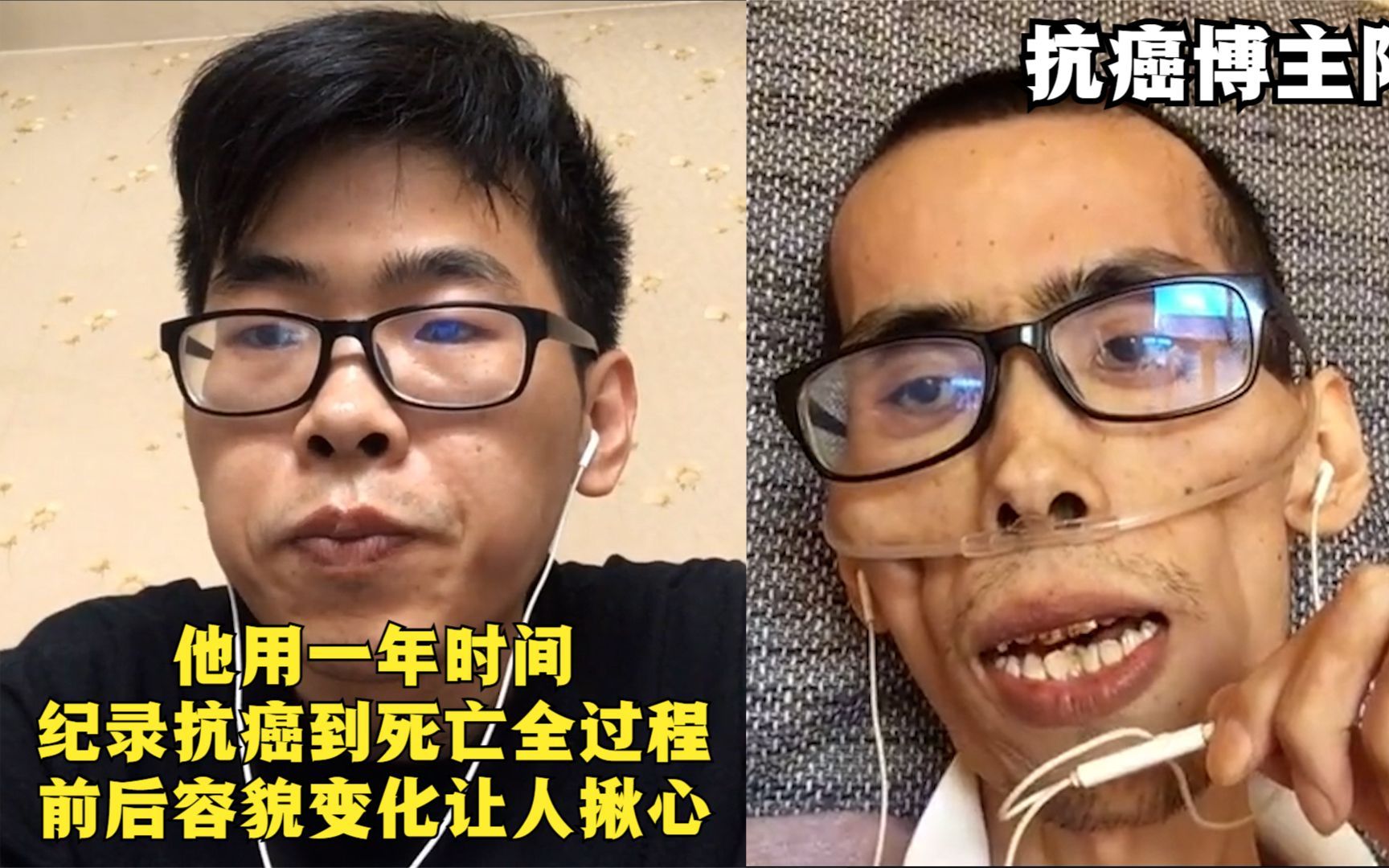 [图]癌症晚期有多痛苦？他用一年时间纪录抗癌到死亡全程，看着太揪心