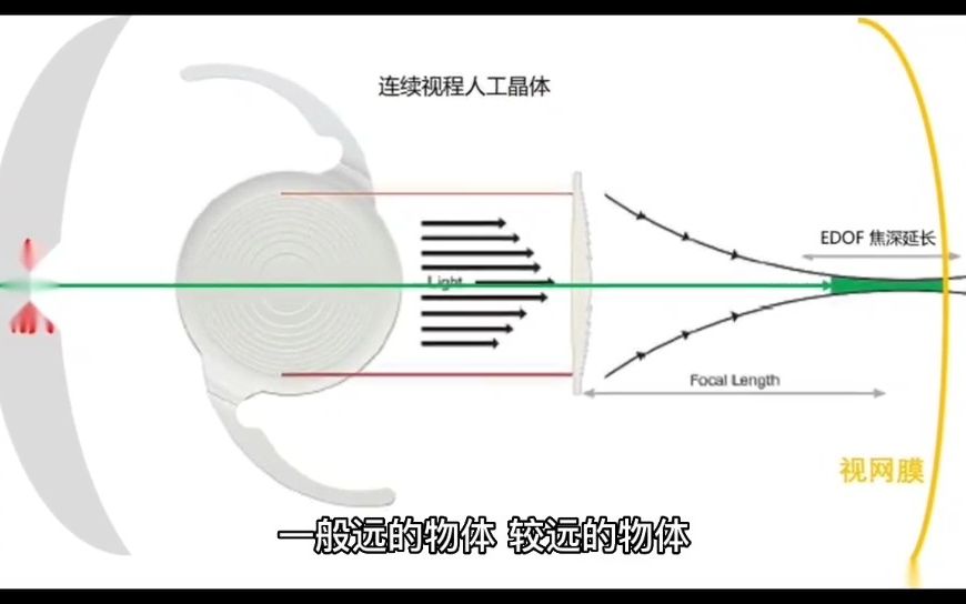 什么是动态视力哔哩哔哩bilibili