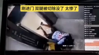 Télécharger la video: 挖槽，刚进门，双腿被切除没了，太可怕了！