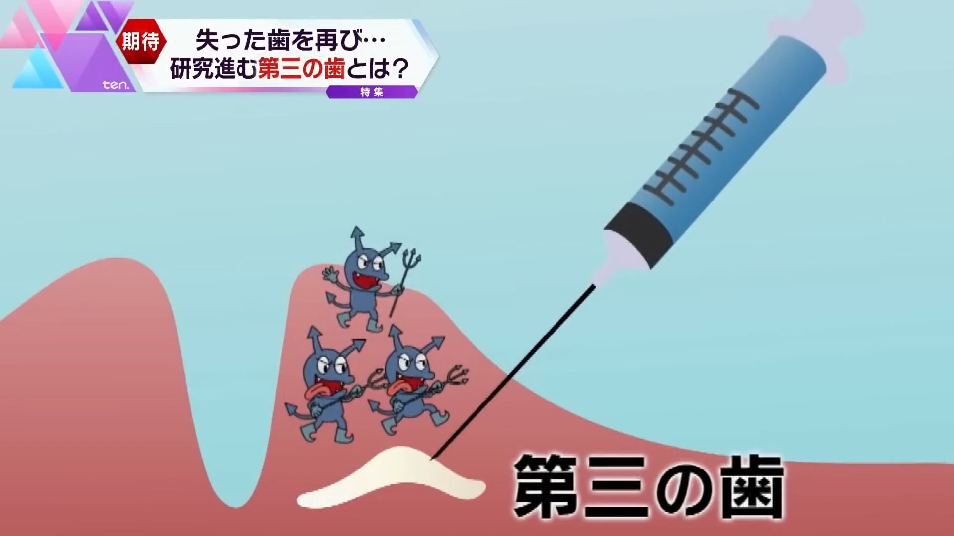 日本全牙再生(今年7月临床一期)和牙髓再生(已经正式临床)哔哩哔哩bilibili