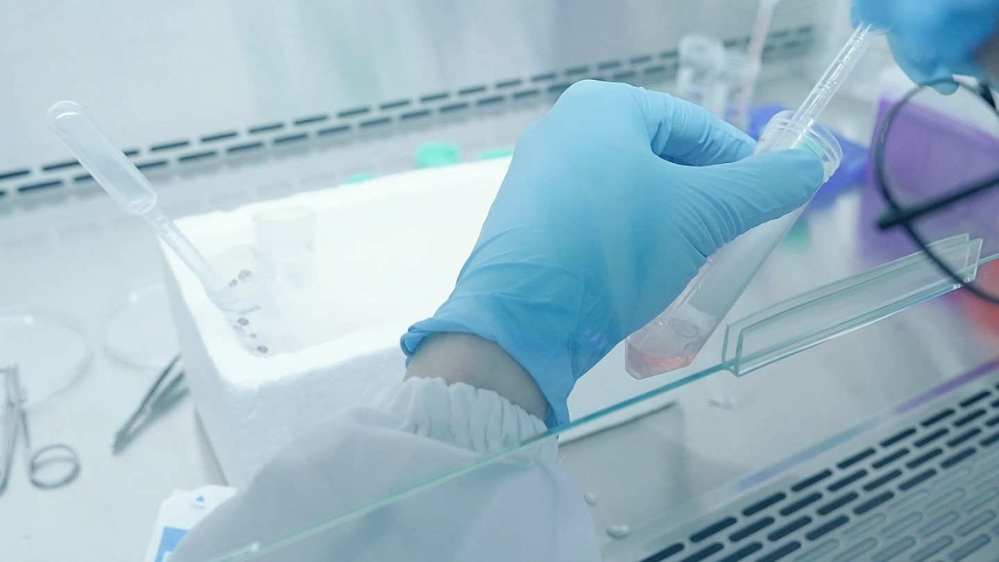 Primary Mouse Intestinal Organoid Culture Protocol