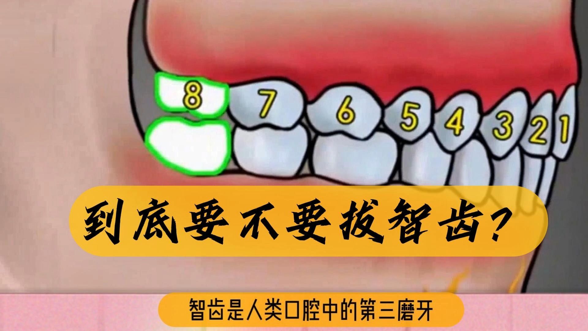 到底要不要拔智齿?哔哩哔哩bilibili