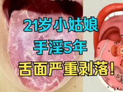 Download Video: 21岁小姑娘，晚上频繁手淫，舌苔严重剥落，不爱惜自己身体！！