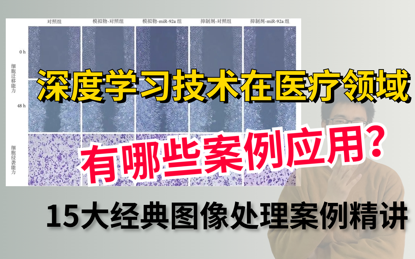 深度学习技术在医疗领域有哪些案例应用?迪哥精讲15大经典图像处理案例,原理解读+代码实战!哔哩哔哩bilibili