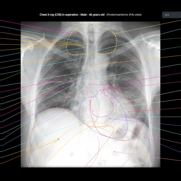 医学生入门必备！超详细胸腹盆X线平片解剖标注！_哔哩哔哩_bilibili