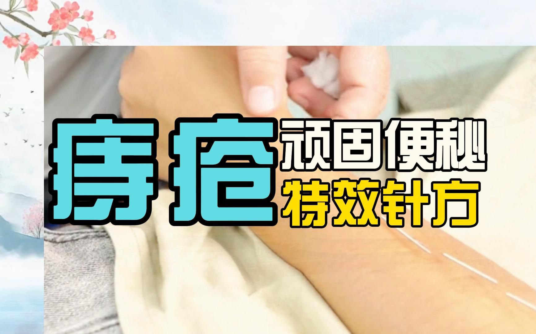 刘红云针灸教学全集 董氏针灸