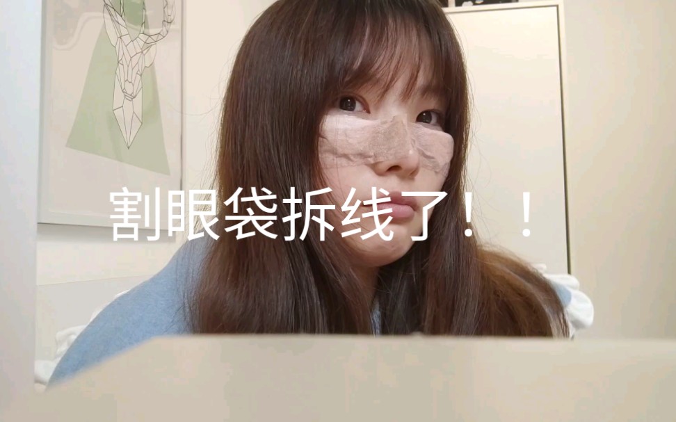 内切去眼袋拆线哔哩哔哩bilibili