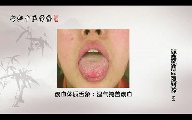 [图]罗大伦-家庭实用中医舌诊  第八讲