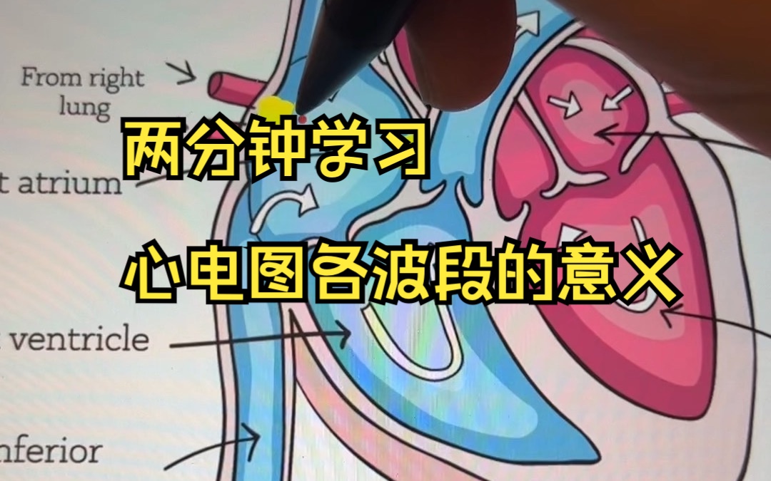 【原创】两分钟学习 心电图基础知识 每个波段的意义和心电图正负极波段 形成原理哔哩哔哩bilibili