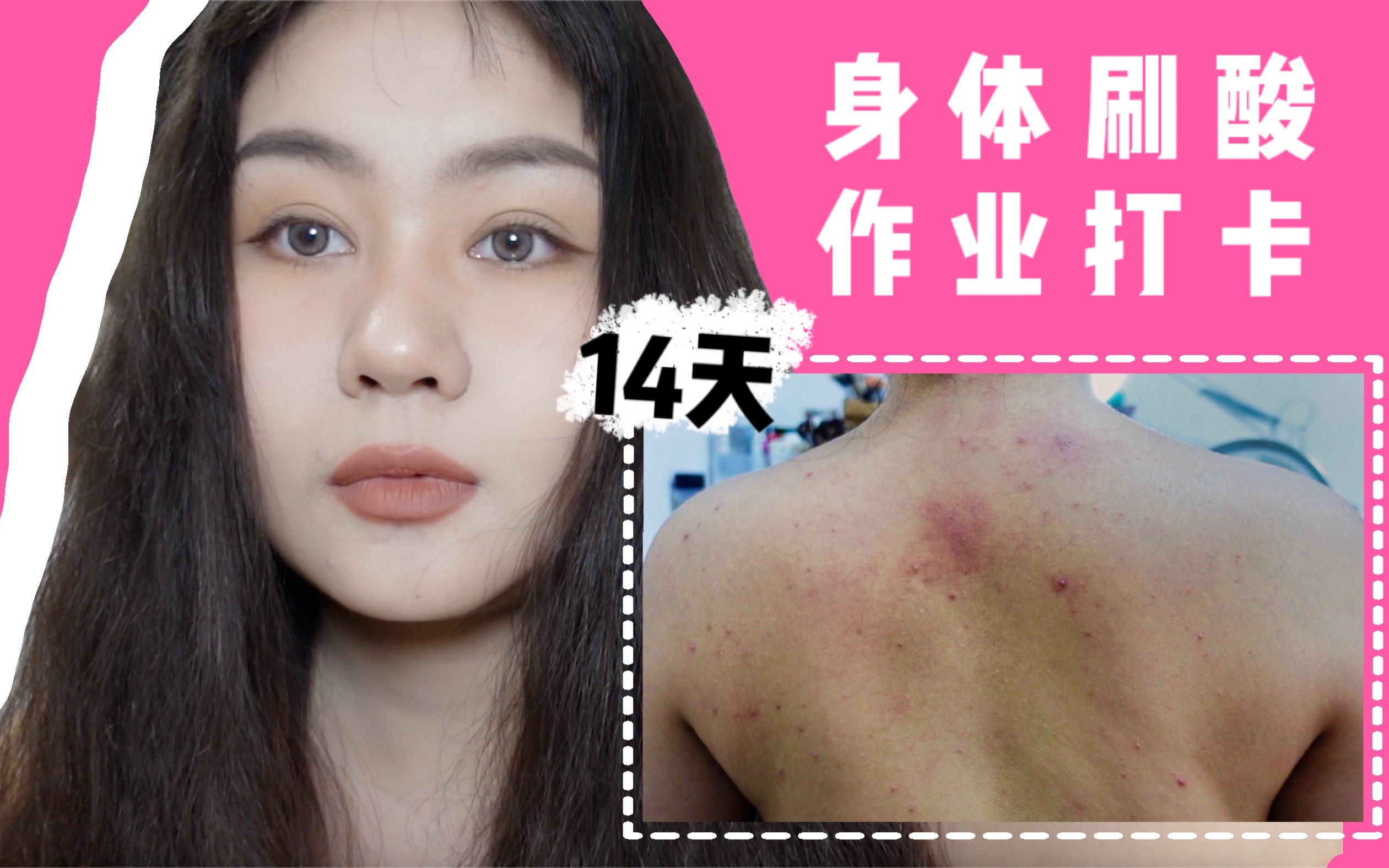 六姨身体刷酸保姆级教程14天实测交作业来啦