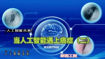 当人工智能遇上癌症（二）