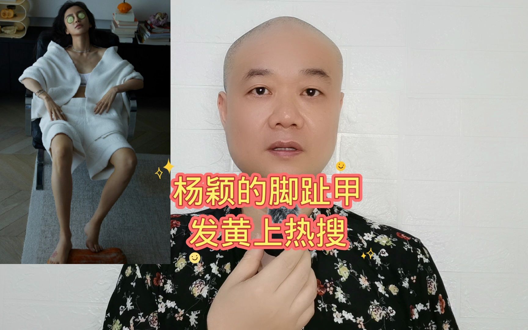 杨颖的脚趾甲:发黄上热搜!哔哩哔哩bilibili