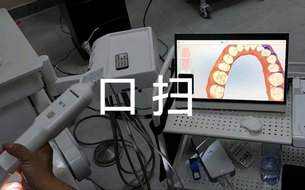 [图]【口扫】数字化口内扫描