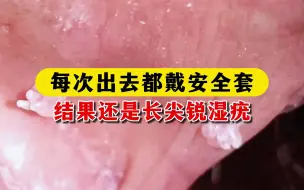 Tải video: 每次出去都戴安全套，结果还是长尖锐湿疣