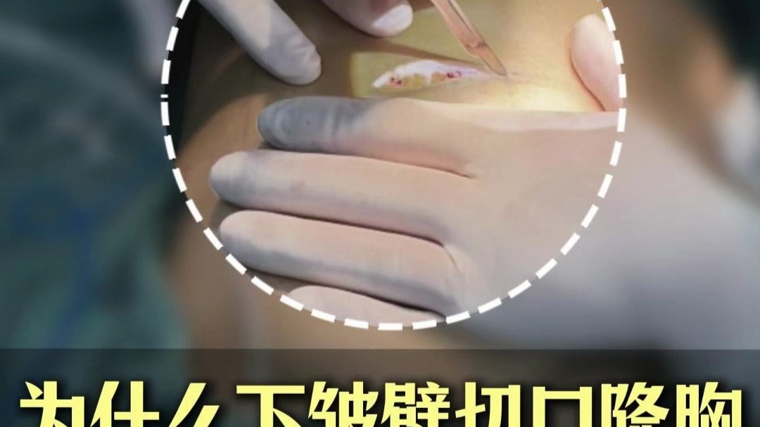 为什么下皱襞切口隆胸,假体最不易下滑?