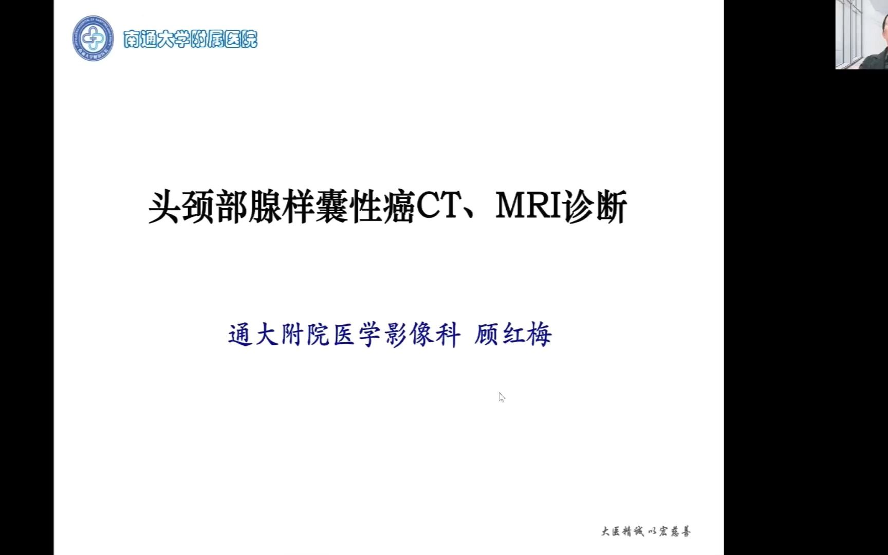 头颈部腺样囊性癌CT、MRI诊断哔哩哔哩bilibili