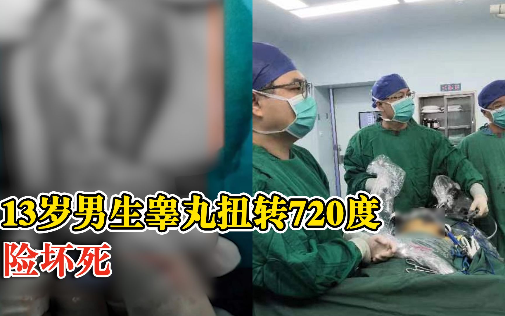 男孩睾丸扭转2周贻误8小时才就医,医生:没好意思说就上学去了哔哩哔哩bilibili