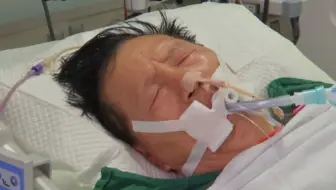 浙江73岁老人脱衣跳江救人体力不支，之后住进ICU抢救一整夜