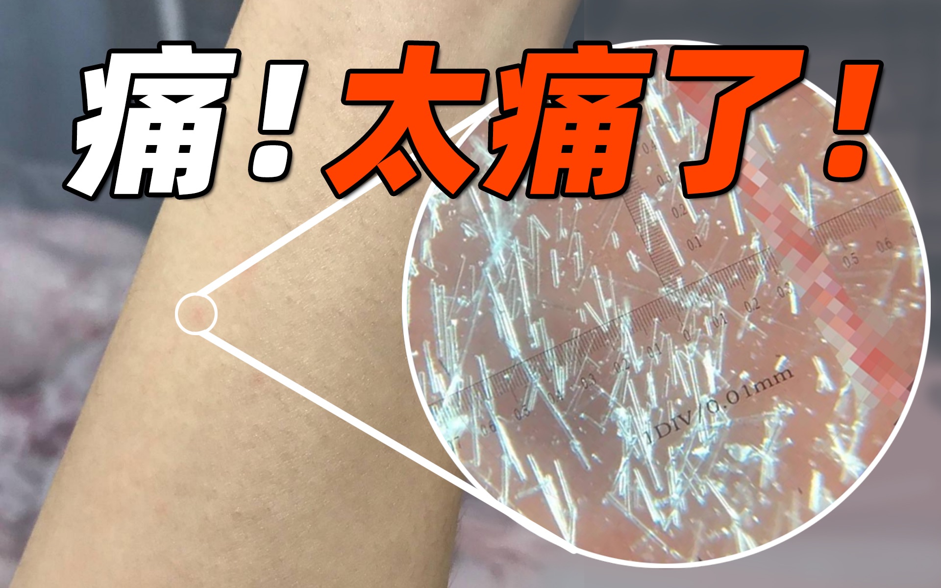 水针草的功效(水针草:清热解毒,润肺止咳 | 中药功效解析)