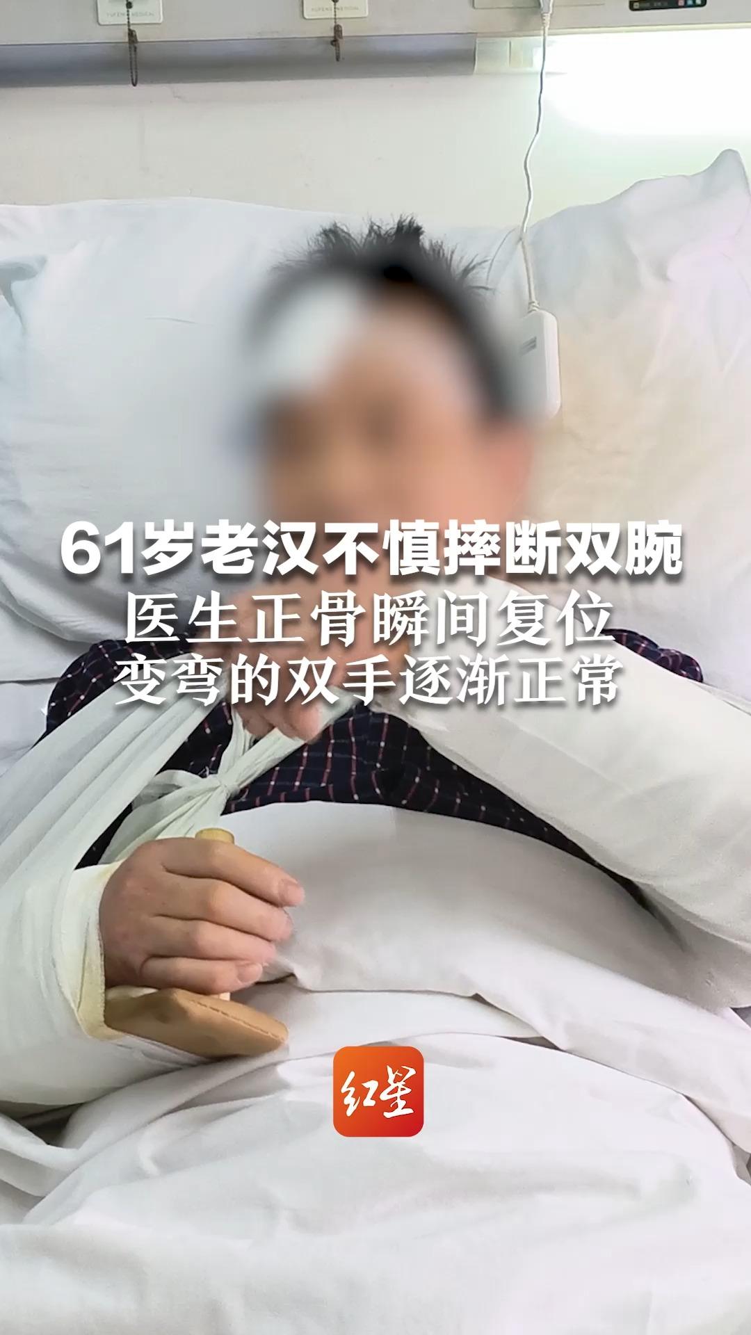 61岁老汉不慎摔断双腕,医生正骨瞬间复位,双手立即就能活动哔哩哔哩bilibili