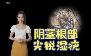 Tải video: 阴茎根部尖锐湿疣症状图片 - 医学科普 |有图有真相