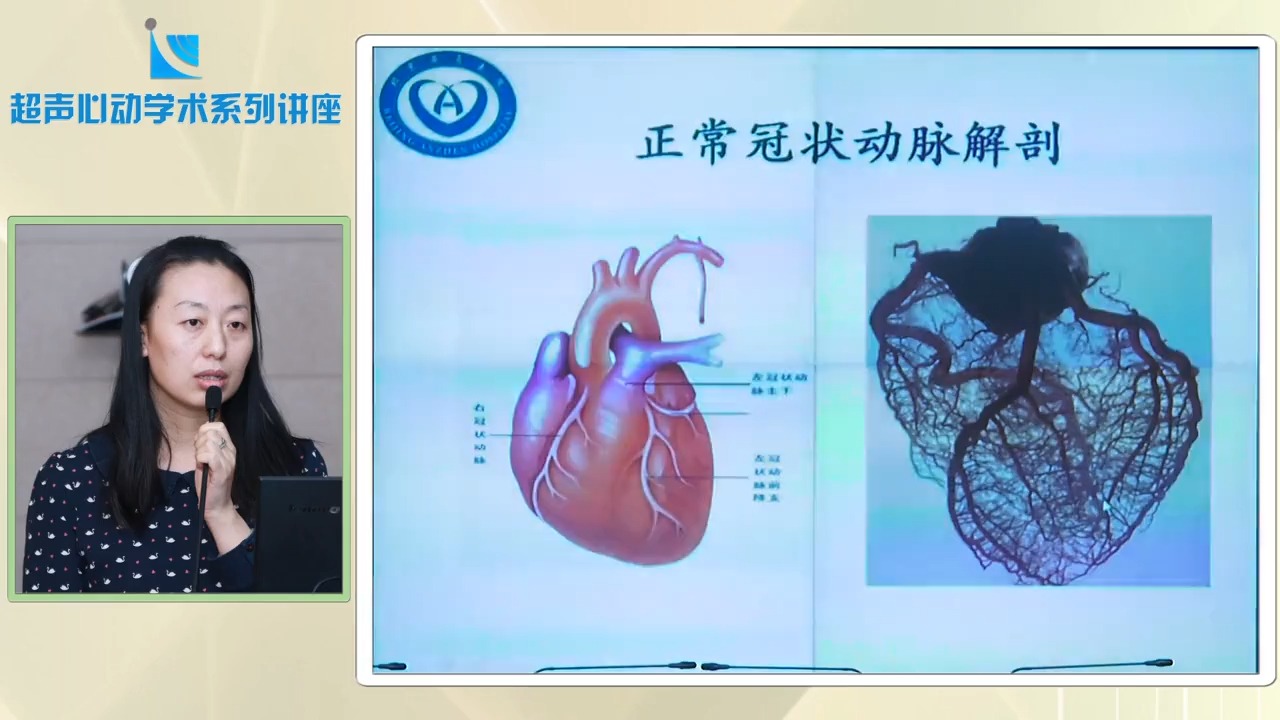 21.左冠状动脉异常起源于肺动脉病例分析(1)——李文秀哔哩哔哩bilibili