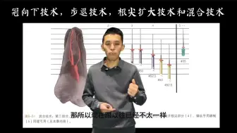 Video herunterladen: 《玩转根管》视频课（8）《根管疏通》