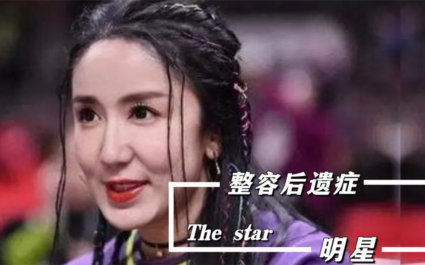 明星医美过度有多恐怖?水果姐眼睛不听使唤,任娜英鼻子捏变形哔哩哔哩bilibili