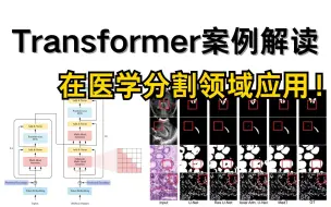 Descargar video: 医学图像分割的视觉Transformer：2024最新医学分割领域实战案例，看完可想出不错的idea！