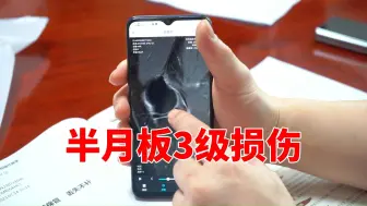 Download Video: 腿疼，下蹲困难，半月板3级损伤的治疗方法