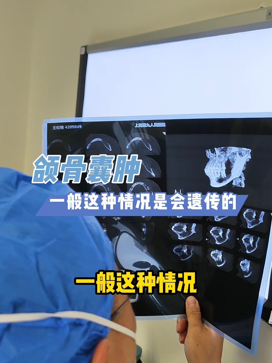 颌骨囊肿可能遗传的现象