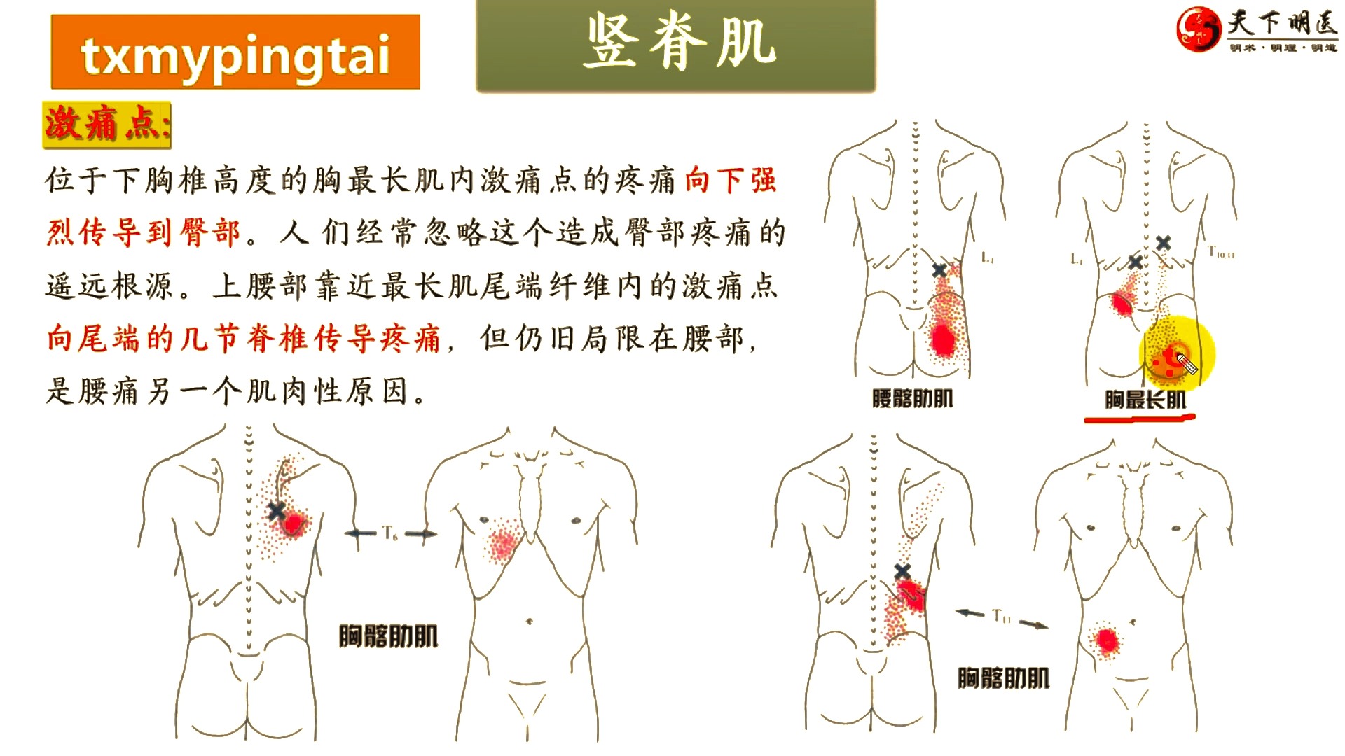 竖脊肌位置图片图片