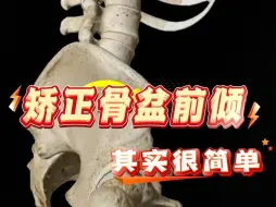 Download Video: 【体态矫正】矫正骨盆前倾，其实很简单