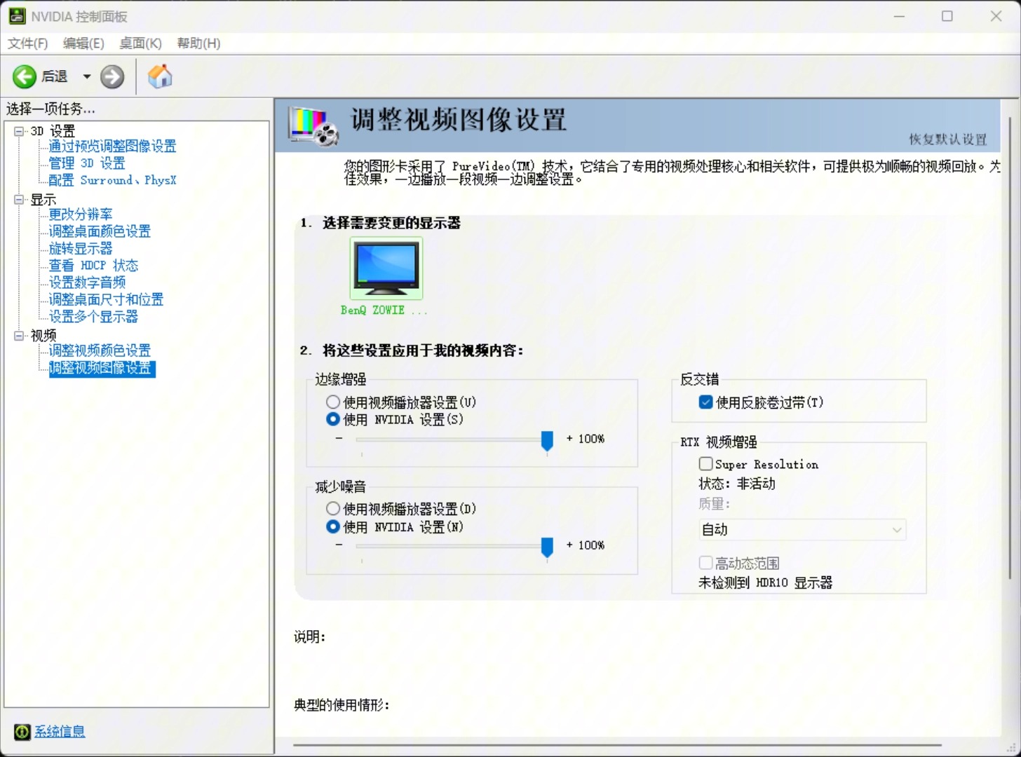 逆战游戏中的设置电子竞技热门视频