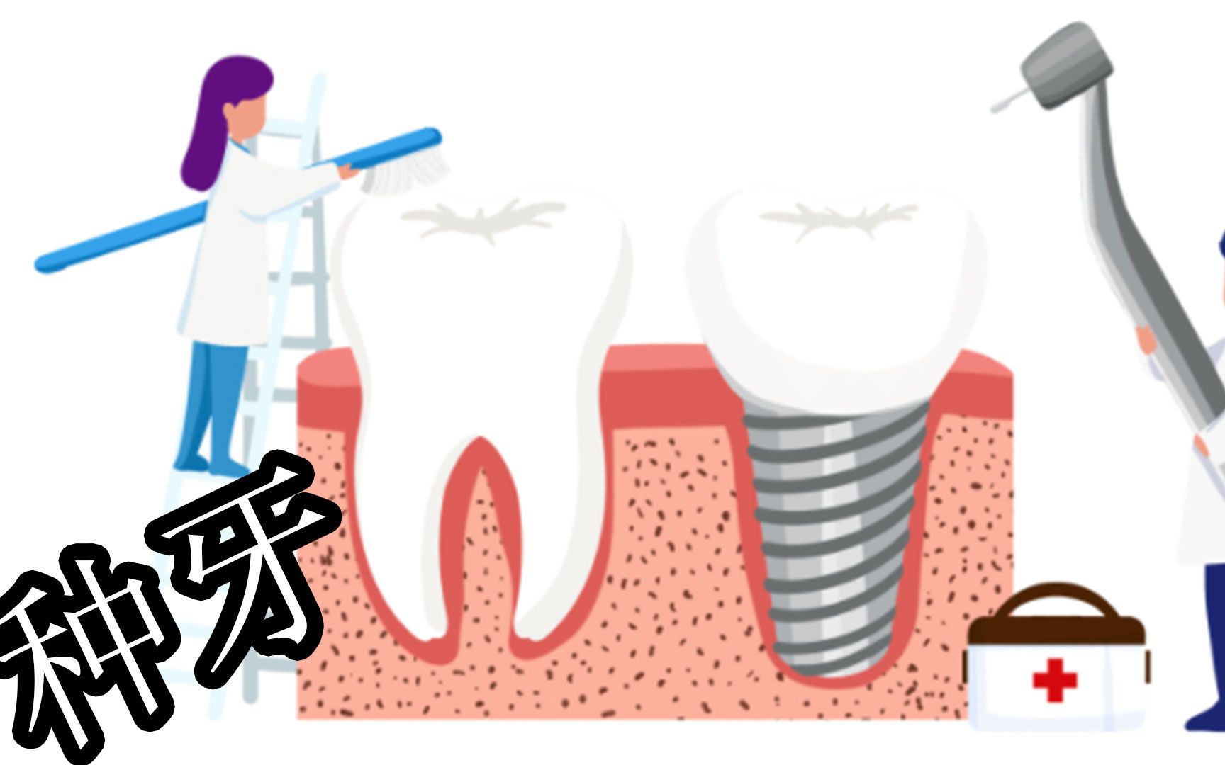 牙齿种植,你听说过吗?一个视频告诉你种牙的全过程哔哩哔哩bilibili