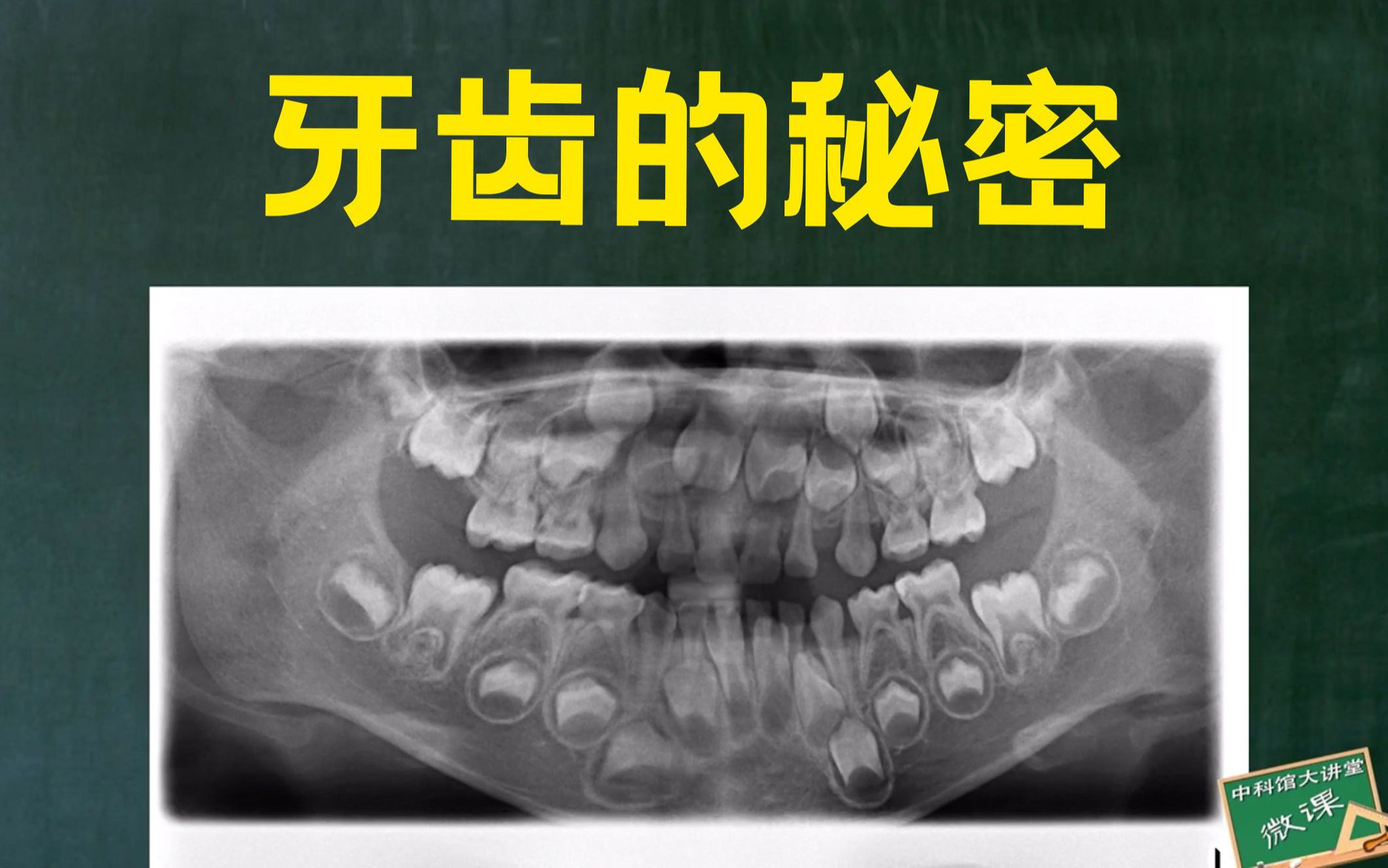 牙齿这么重要,你对它的了解有多少?哔哩哔哩bilibili