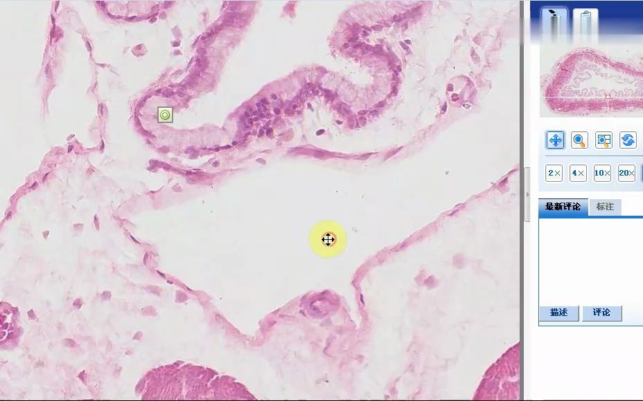 单层扁平上皮显微镜图图片