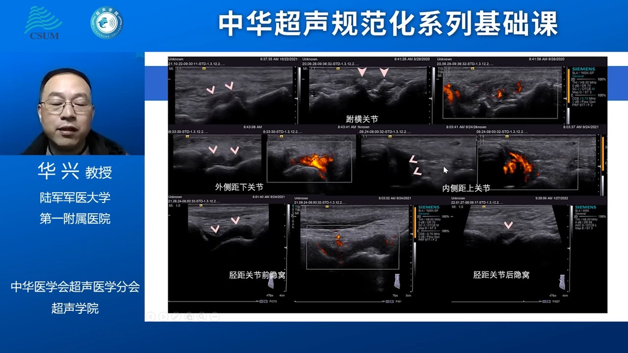 第13期 足踝关节常见疾病的超声评价|华兴 教授