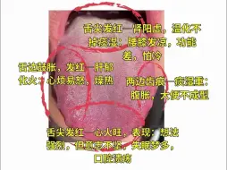 Video herunterladen: 上热下寒，肾阳虚，地黄丸，肾气丸，你越用越上火