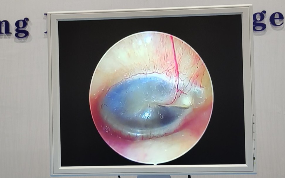 山东耳净耳镜厂家耳镜检查仪可视耳镜检查仪器可视耳镜检查设备耳镜
