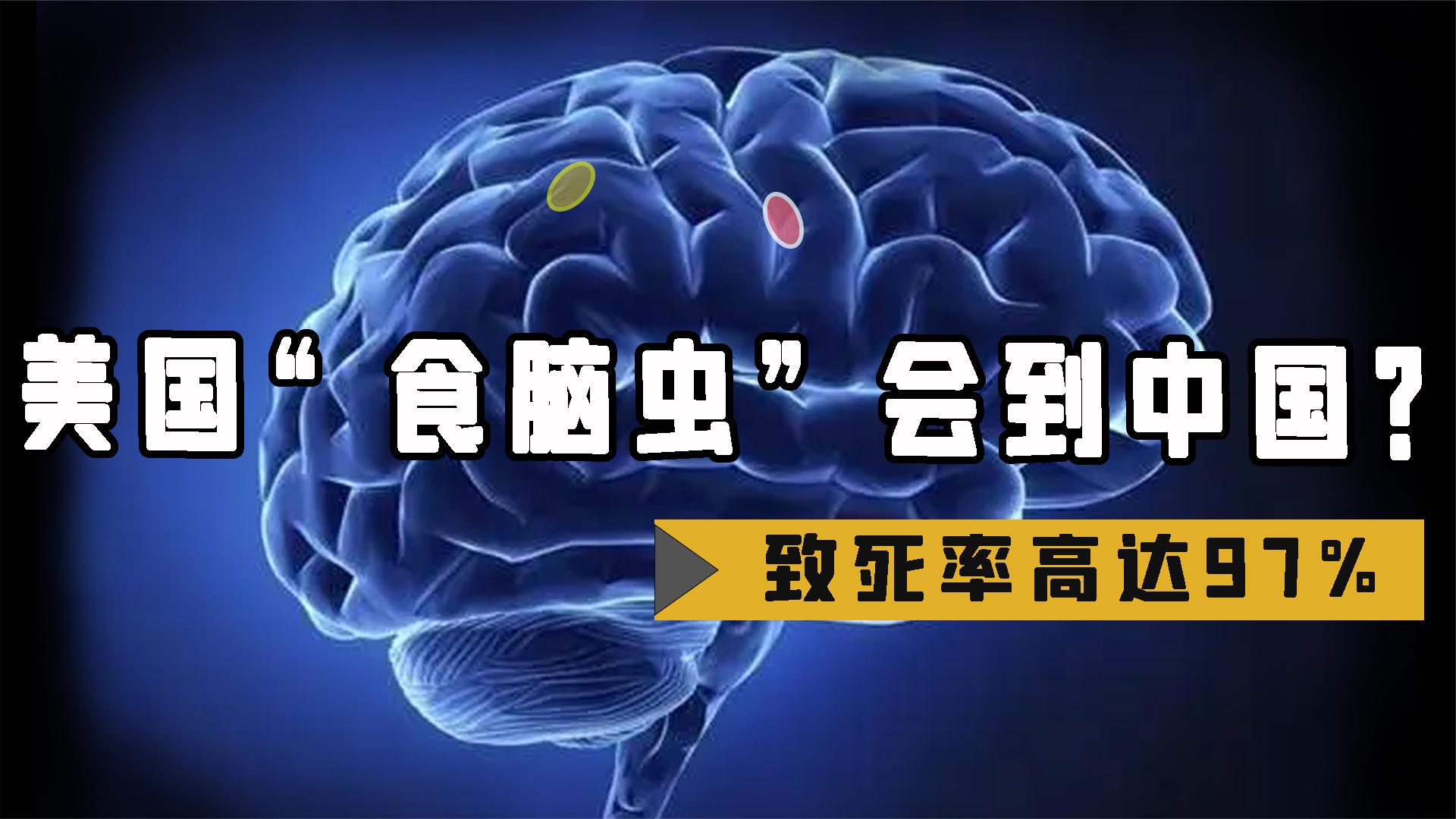 致死率97%的"食脑虫"会传到中国?美国再现食脑虫,该如何预防