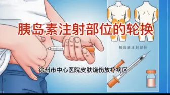 Download Video: 胰岛素注射部位的轮换