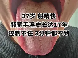 Download Video: 戴个套的工夫，就容易变软，硬度差，射精没有力度