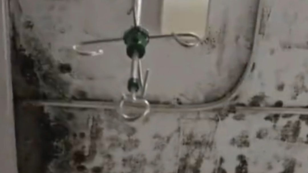 湛江一医院病房房顶大面积发黑发霉，引发网友对住院就医环境的担忧！院方：系个别现象 已将患者转移。