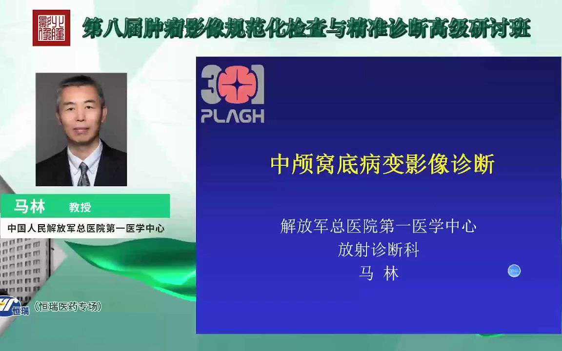 【自学专用】中颅窝病变影像诊断哔哩哔哩bilibili