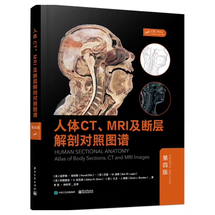 [图]人体CT、MRI及断层解剖对照图谱 第4版_李哲，林科宇主译2021年（彩图）高清版PDF