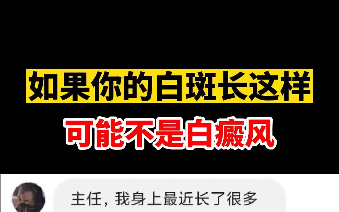 如果你的白斑长这样,可能不是白癜风哔哩哔哩bilibili