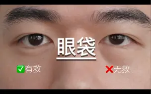 Video herunterladen: 血泪教训，不是什么眼袋都得「割」！！！